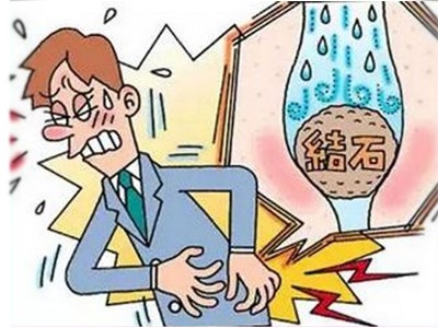 图片上传